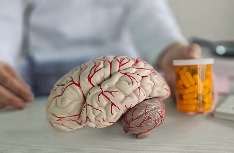 Профиль тревожных расстройств у пациентов с первичными головными болями